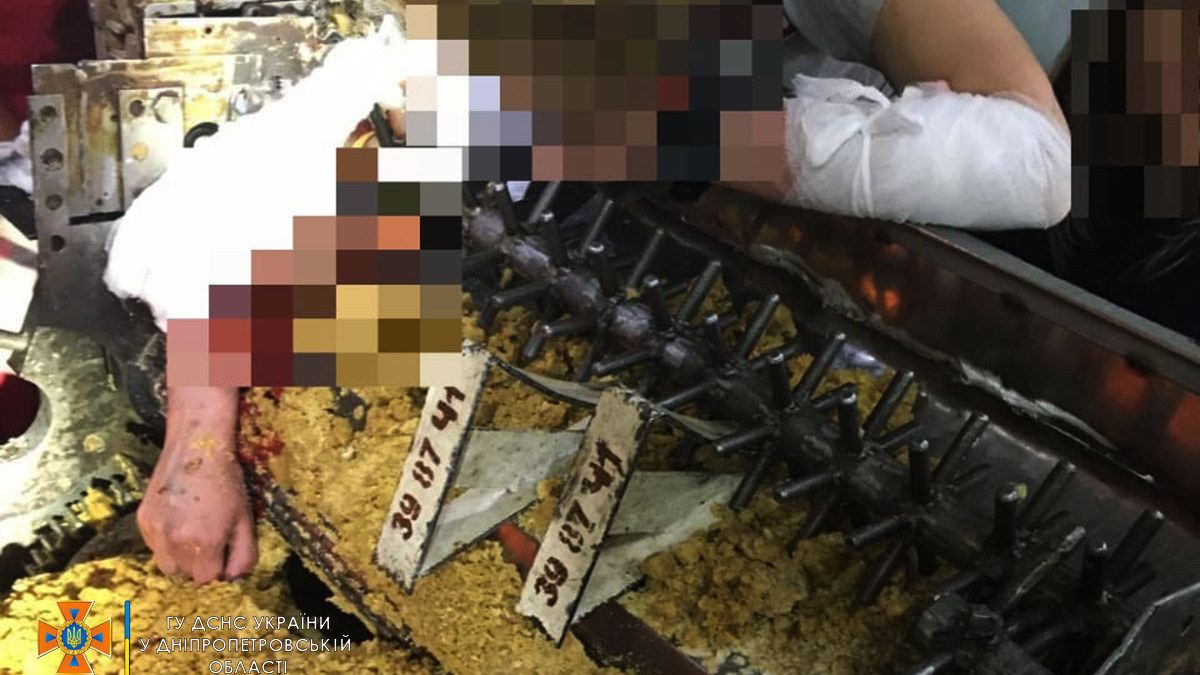 В Днепре на Океанской 27-летняя женщина застряла рукой в кондитерском станке