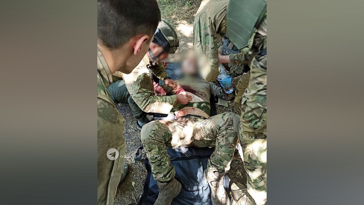 Оперировали 6 часов: раненому бойцу ТрО Днепра нужна помощь