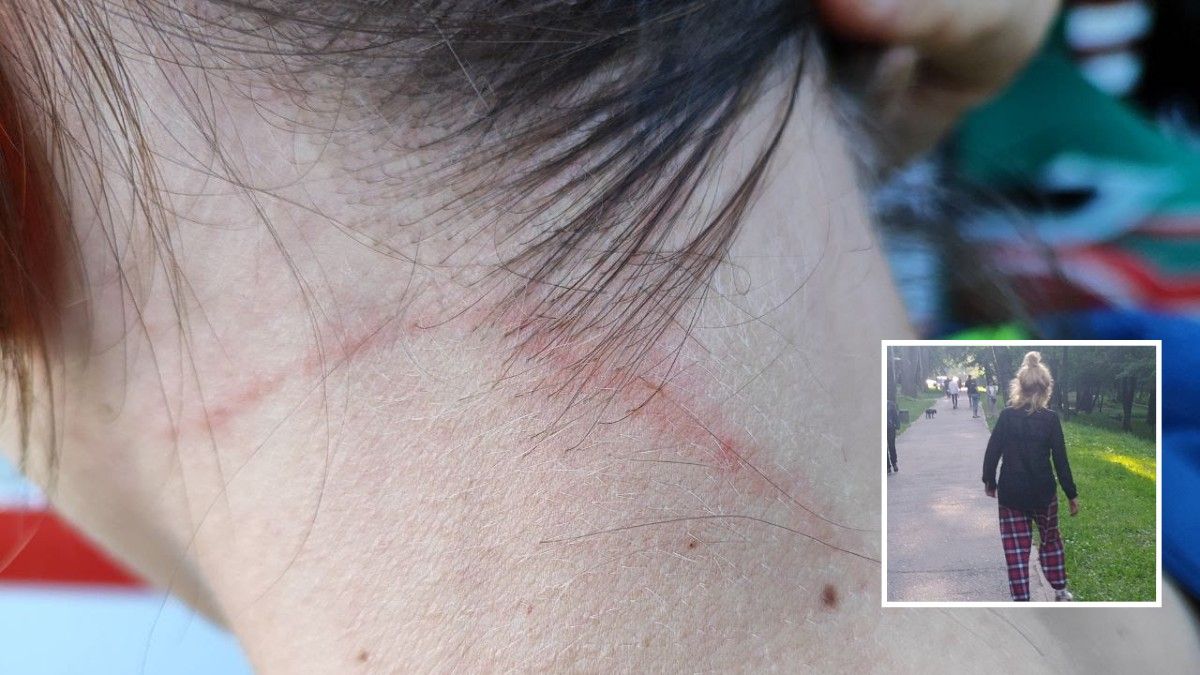 Душила фонендоскопом и разодрала шею: в Днепре пьяная женщина напала на врачей скорой