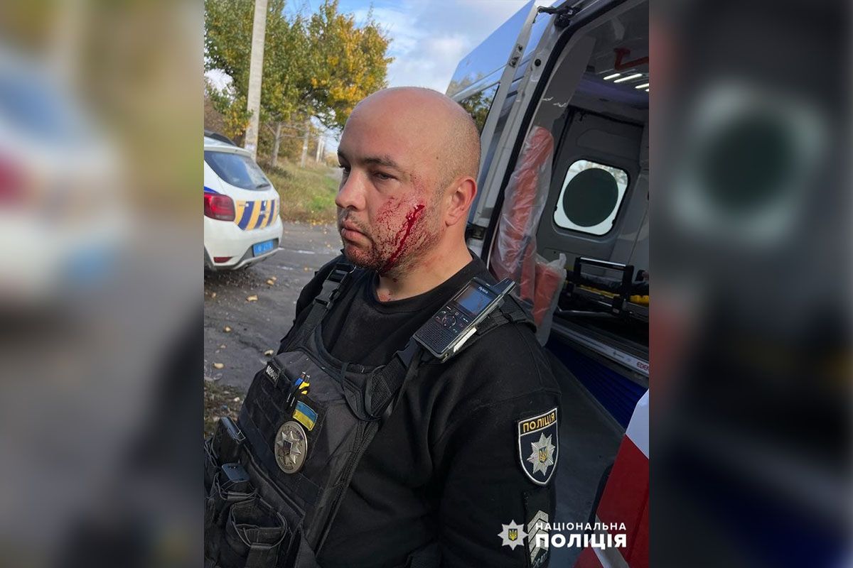 Мужчина с ножом напал на полицейского Мужчина с ножом напал на полицейского