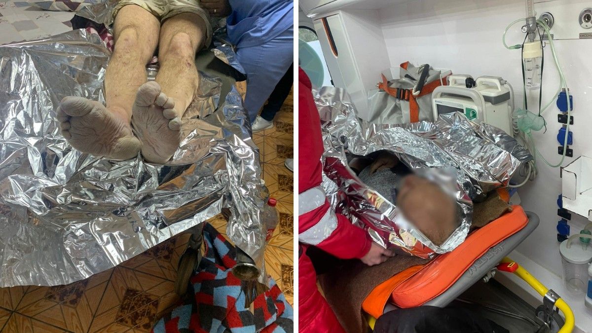 Чоловік обморозив ноги