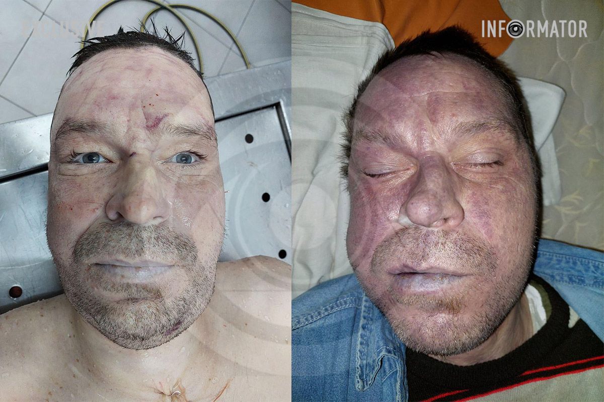 Правоохоронці встановлюють особу померлого Правоохоронці встановлюють особу померлого