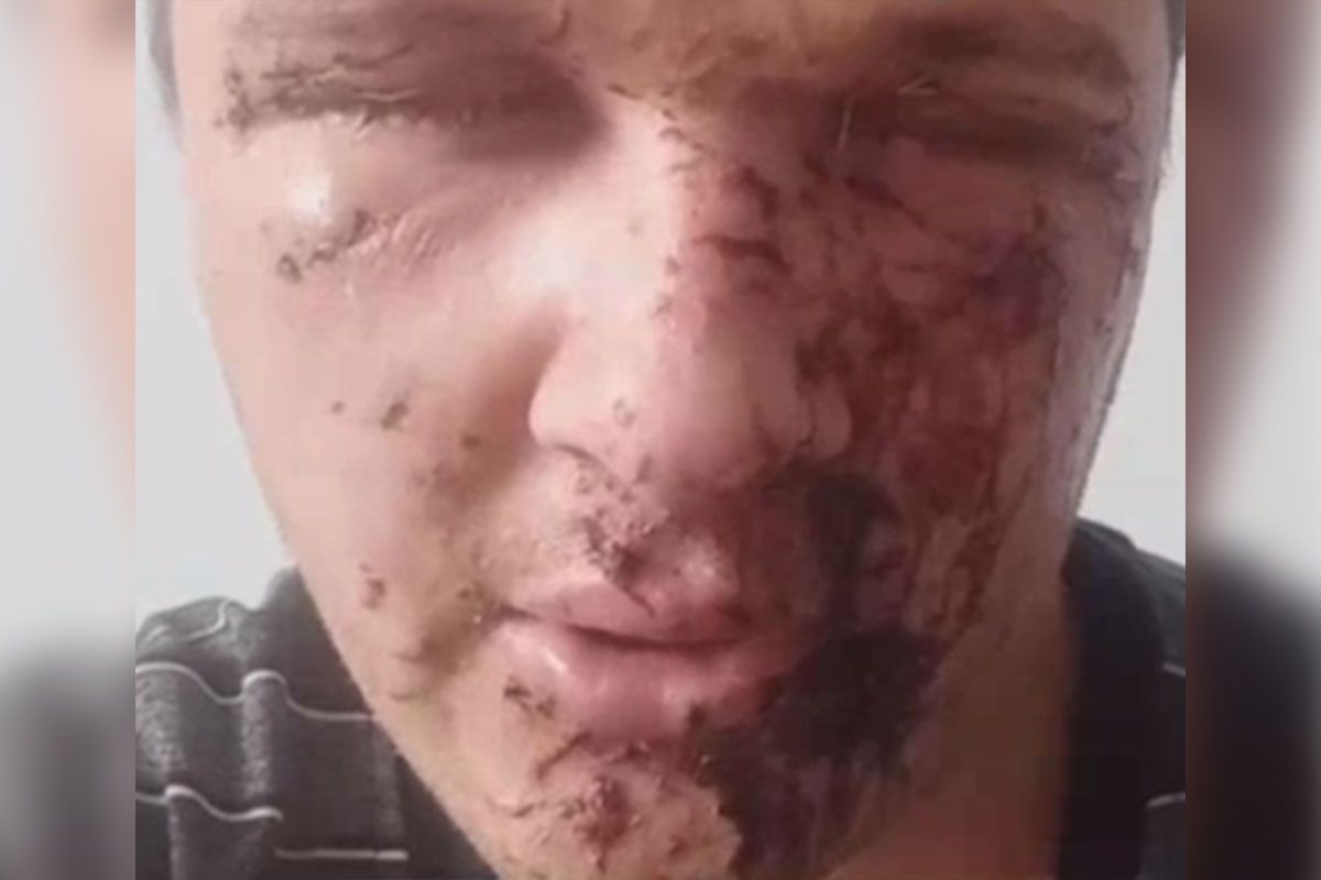 Сейчас мужчина в больнице Сейчас мужчина в больнице