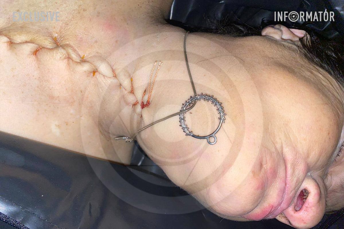 Прикраса на шиї померлої Прикраса на шиї померлої