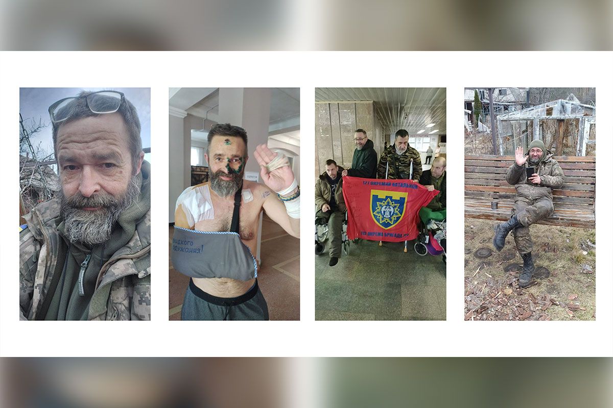 Андрей нуждается в операции по эндопротезированию плечевого сустава Андрей нуждается в операции по эндопротезированию плечевого сустава