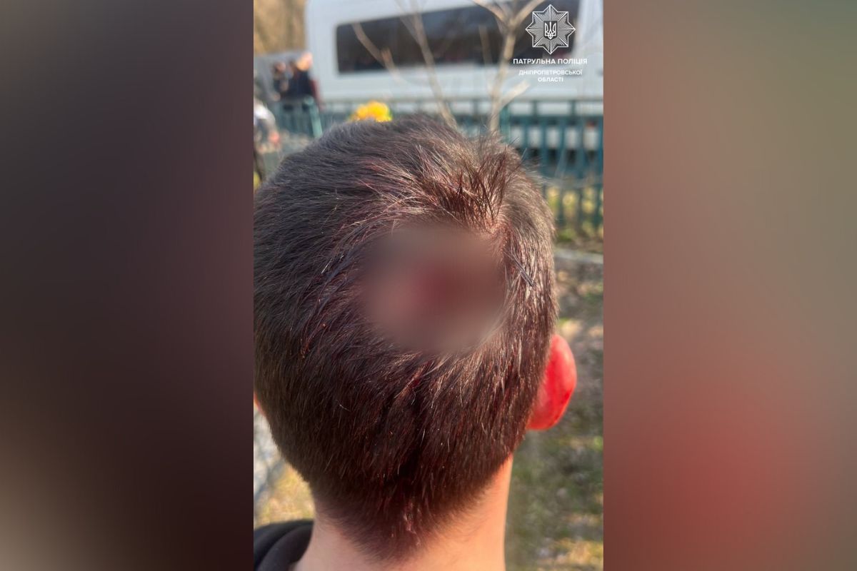 Поранені дві людини - чоловік та його матір