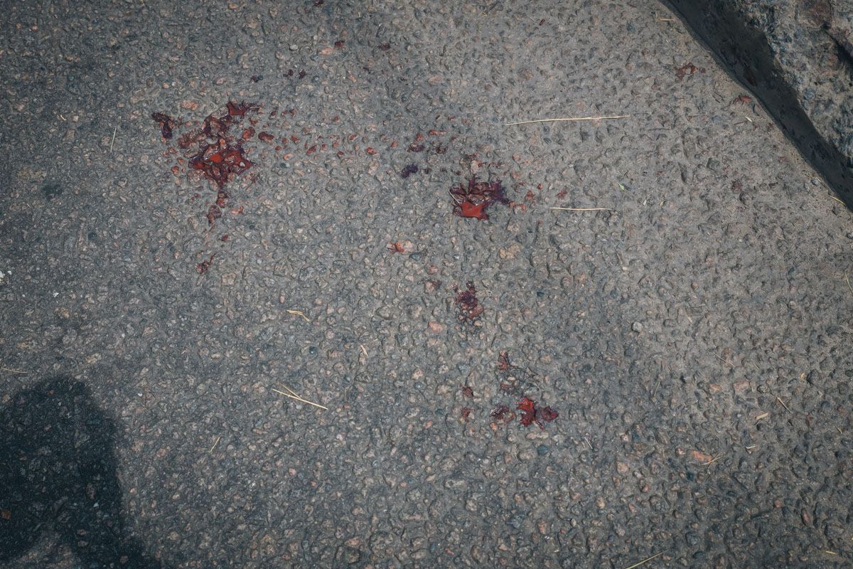 Постраждалому викликали «швидку»