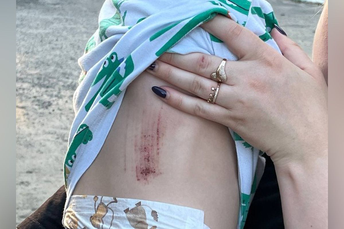 7 липня дворічний хлопчик Дмитро провалився у люк. 7 липня дворічний хлопчик Дмитро провалився у люк.