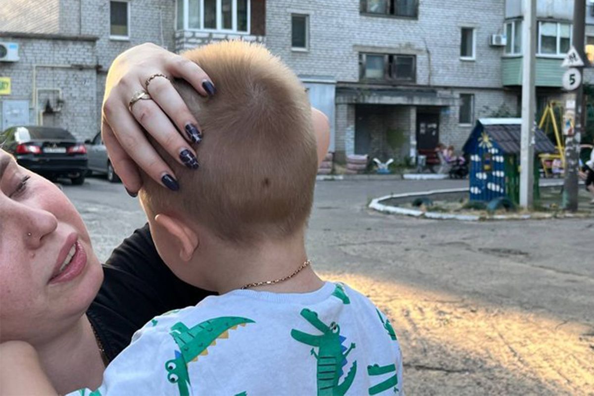 Точкова пробита голова, садна та забій грудної клітини – такі травми діагностували у малюка Точкова пробита голова, садна та забій грудної клітини – такі травми діагностували у малюка