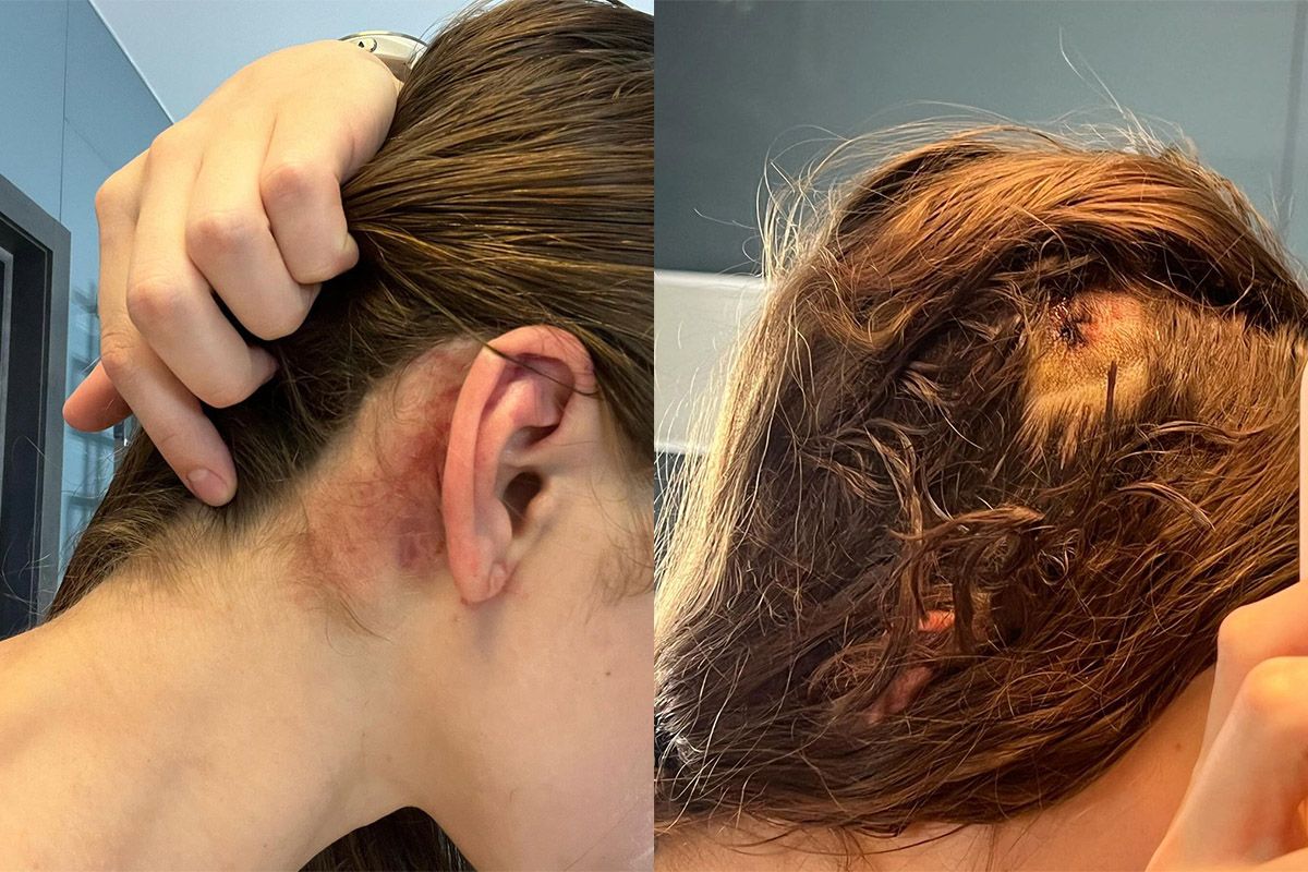 В Днепре избили активистку