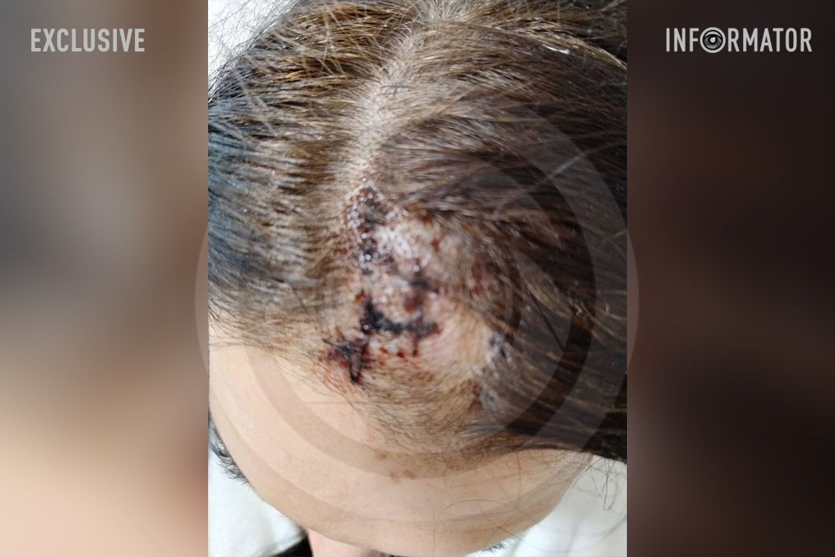 Девушка смогла запомнить своего нападающего