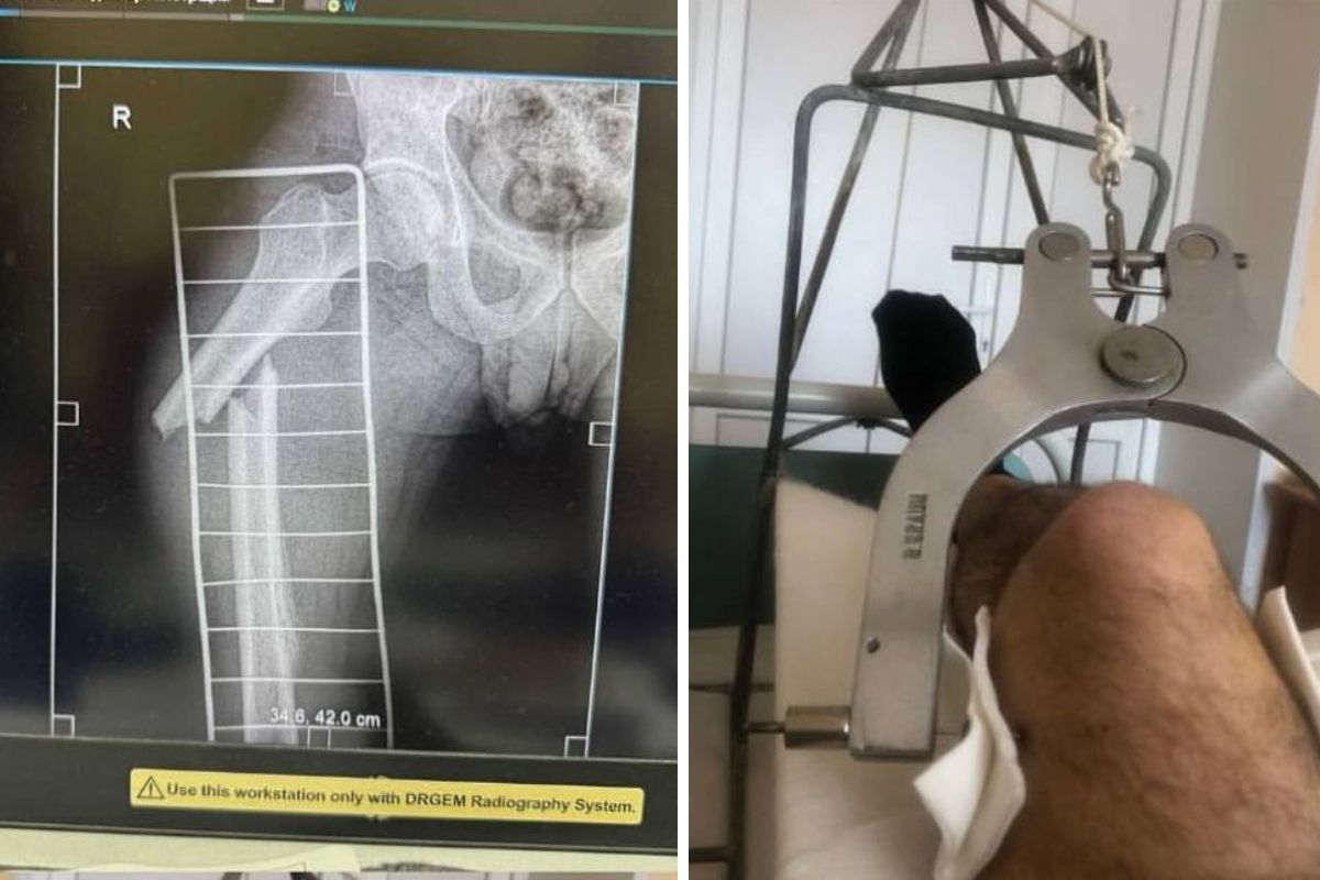 Місцевий житель заявив, що його побили представники ТЦК