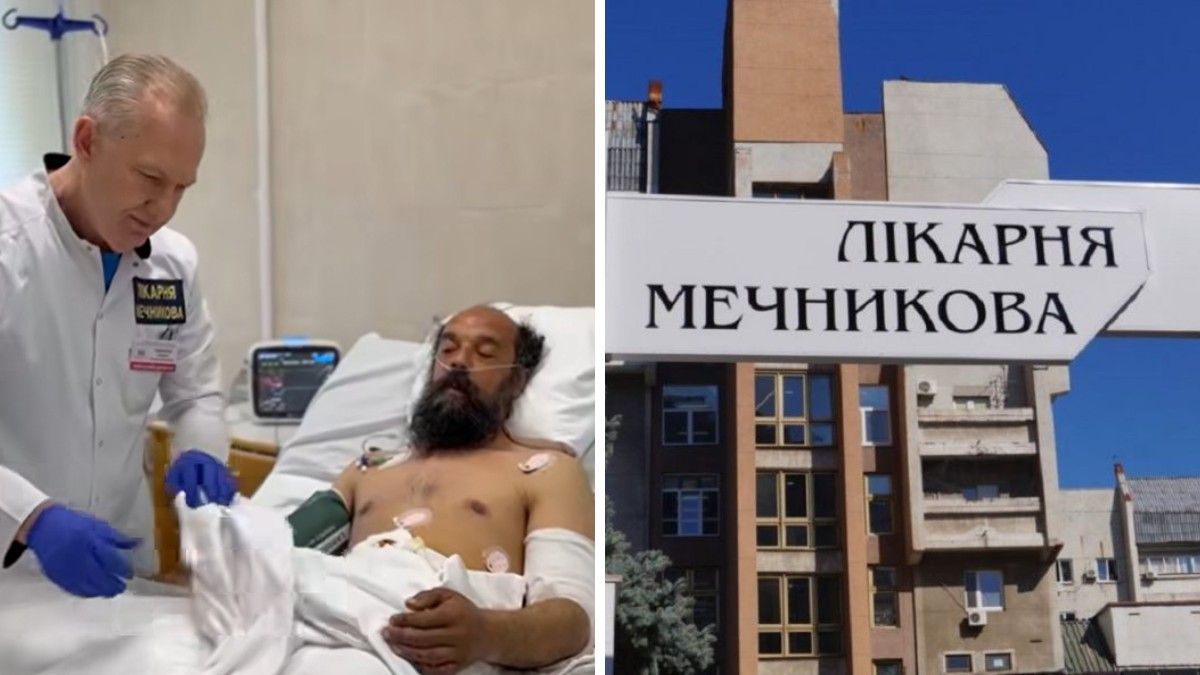 Снаряд разорвался в трех метрах: в Днепре спасают 42-летнего мужчину, которому оторвало ногу