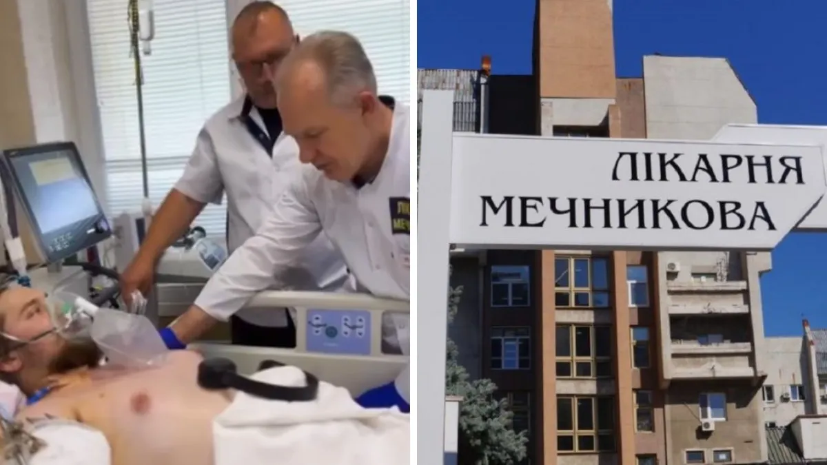 Проводят гемодиализ: в Днепре спасают воина, которому ампутировали ногу