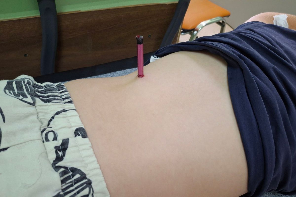 Ребенок упал на карандаш во время игры