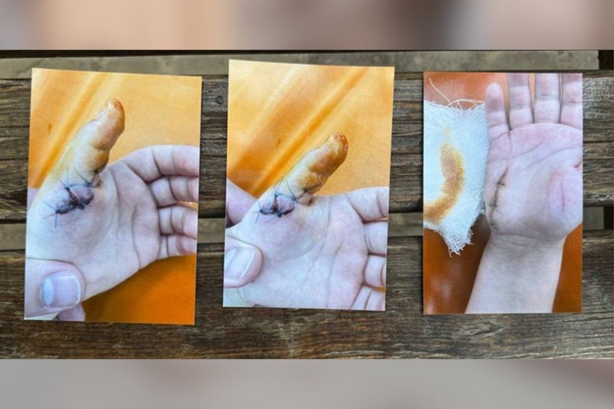 Травми, які отримав хлопчик