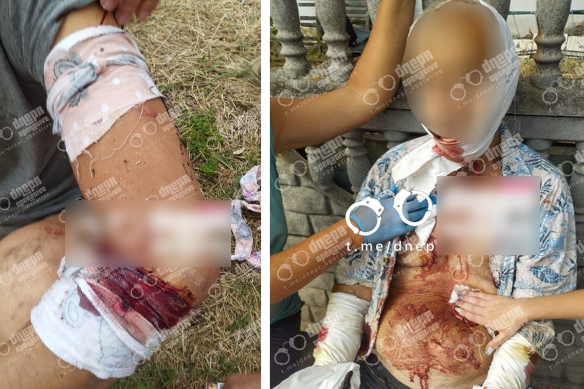 Среди раненых - женщины, спасатели и отец нападающего Пятеро пострадавших: при задержании в Днепропетровской области застрелили 42-летнего мужчину, который с ножом бросался на местных, спасателей и полицию