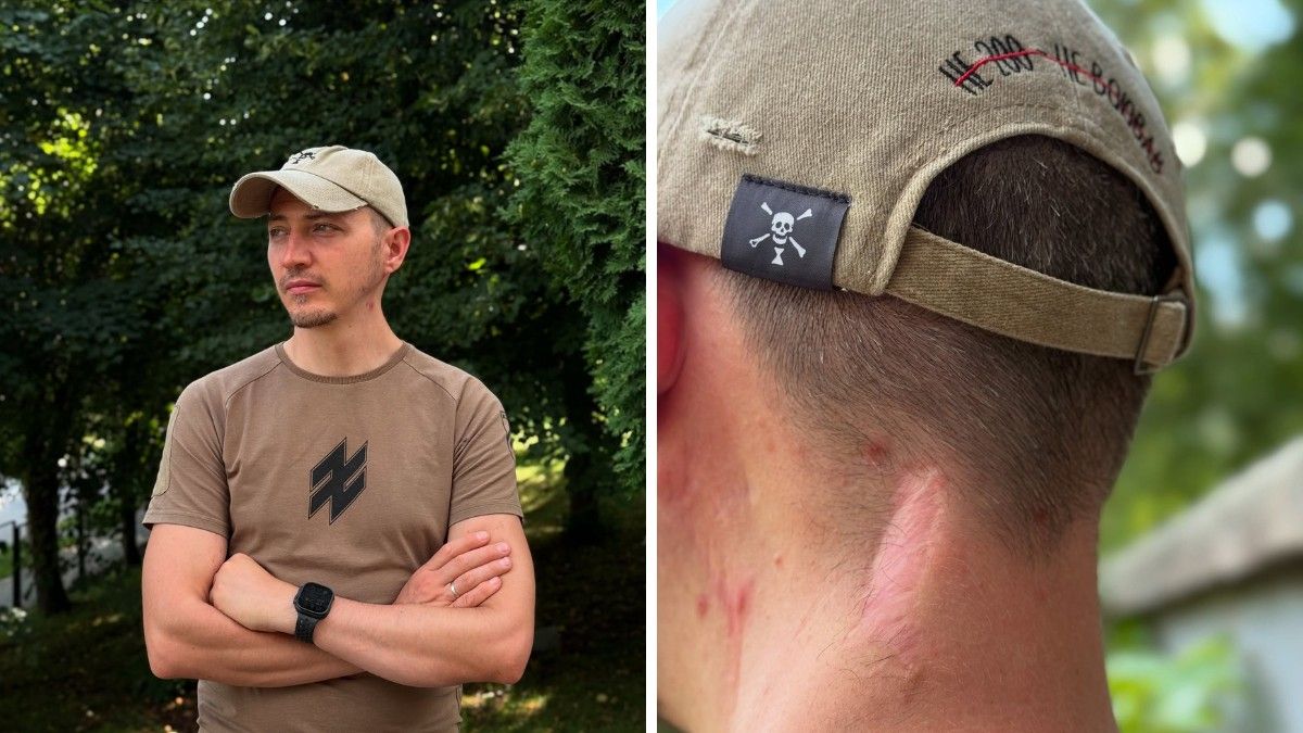 "Нас держали жестче, чем серийных убийц": защитник "Азовстали" Артем Дубина из Никополя рассказал об ужасах российского плена