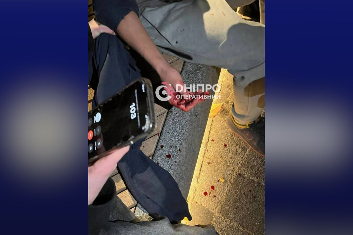 Поврежденная рука ребенка