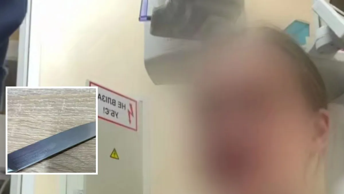 У Дніпрі в клініці Dental Studio керуюча вдарила стоматологиню ножем