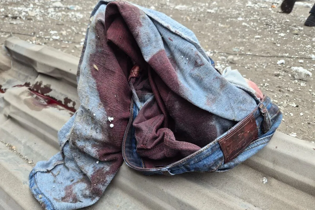 Штани у крові Ракетний удар по Дніпру: як виглядає пошкоджений офіс, в якому загинула жінка 3