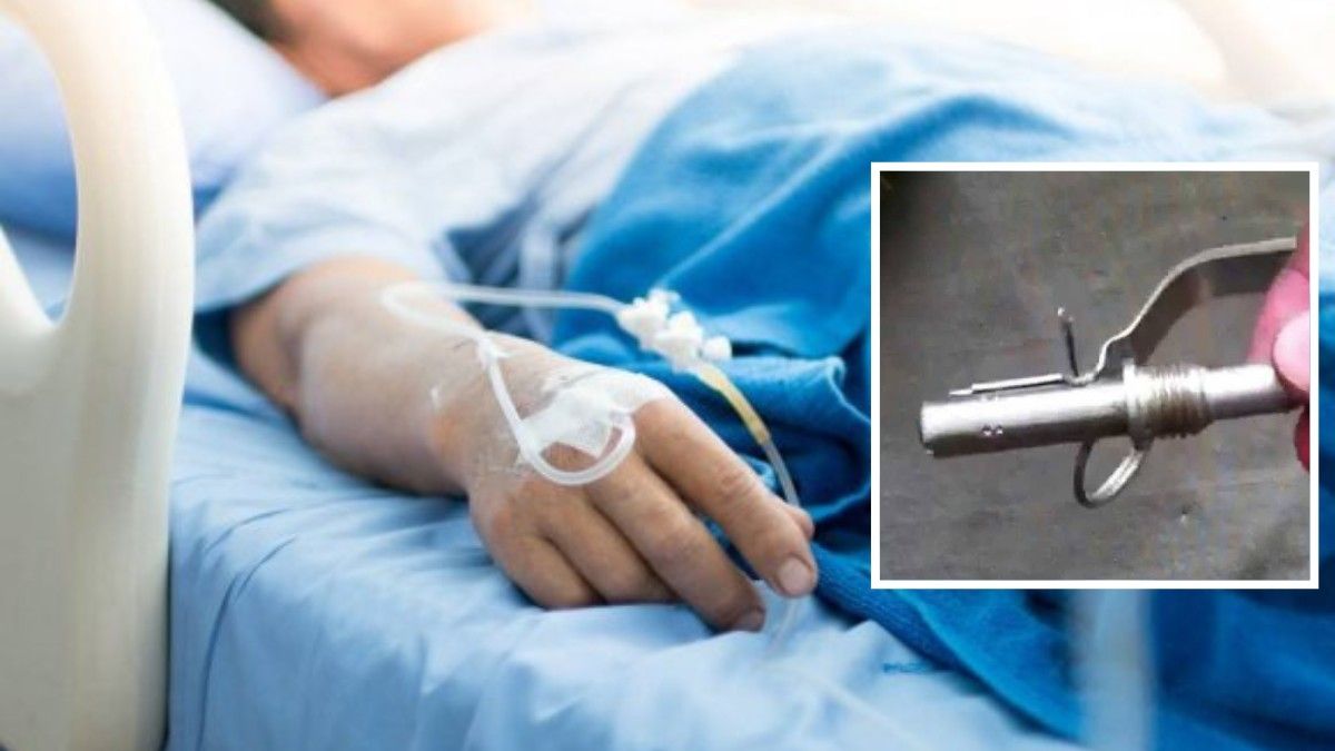 Відірвало два пальці: у Кривому Розі 76-річний чоловік підняв запал від гранати і той здетонував