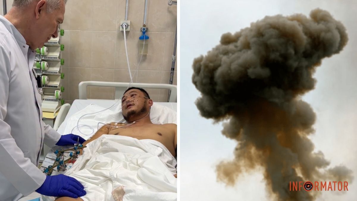 Ампутація правої ноги, перелом ребер та багато уламків у тілі: у Дніпрі рятують бійця Семена Лі