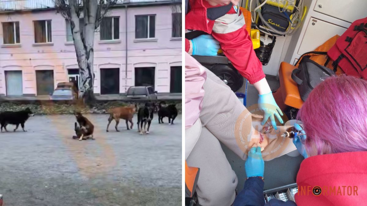 Зграя безпритульних собак покусала жінку на вулиці Павла Скоропадського у Дніпрі