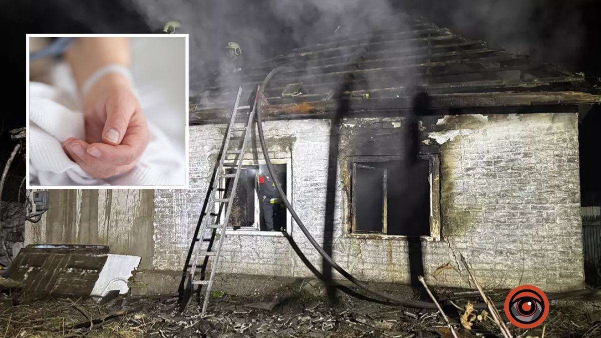 В Дніпрі у Новокодацькому районі загорівся будинок: 47-річного чоловіка забрала «швидка» з опіками рук та обличчя
