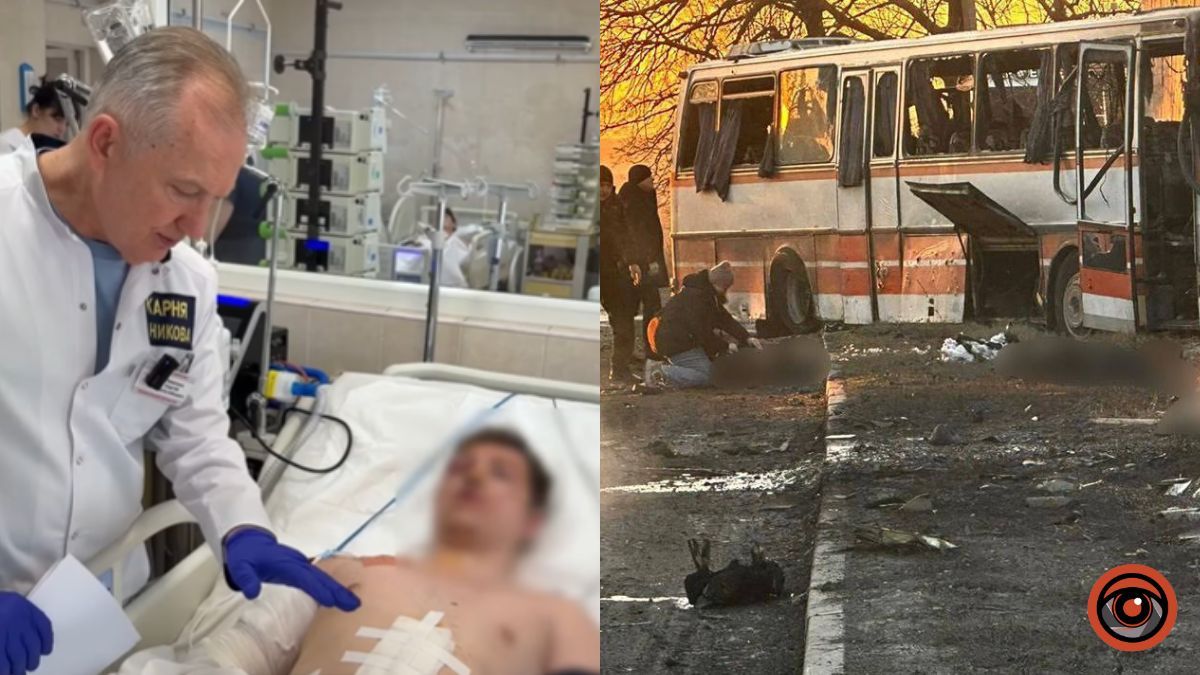 «Боляче, що хлопці, які енергію добувають для країни, страждають»: медики Дніпра рятують шахтарів після атаки по автобусу в Тернівці