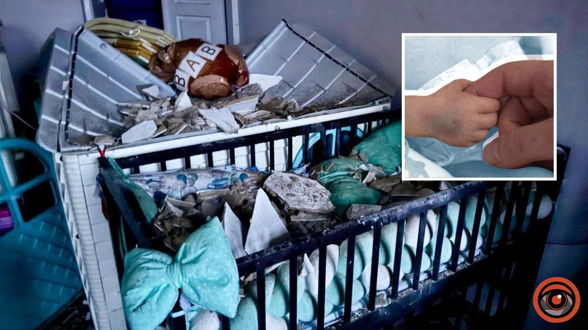 Отримав травму голови: в якому стані перебуває хлопчик, який постраждав від ворожих ударів по Дніпру