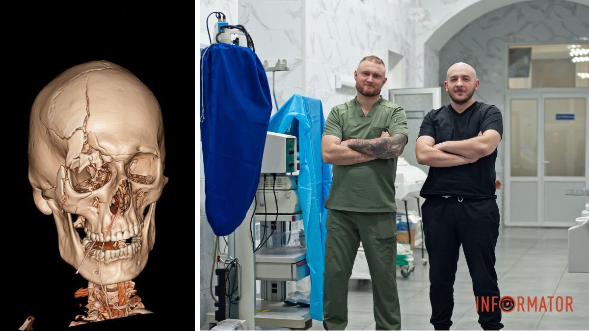 Операція тривала п’ять годин: медики з Дніпропетровської області врятували життя важкопораненому чоловіку