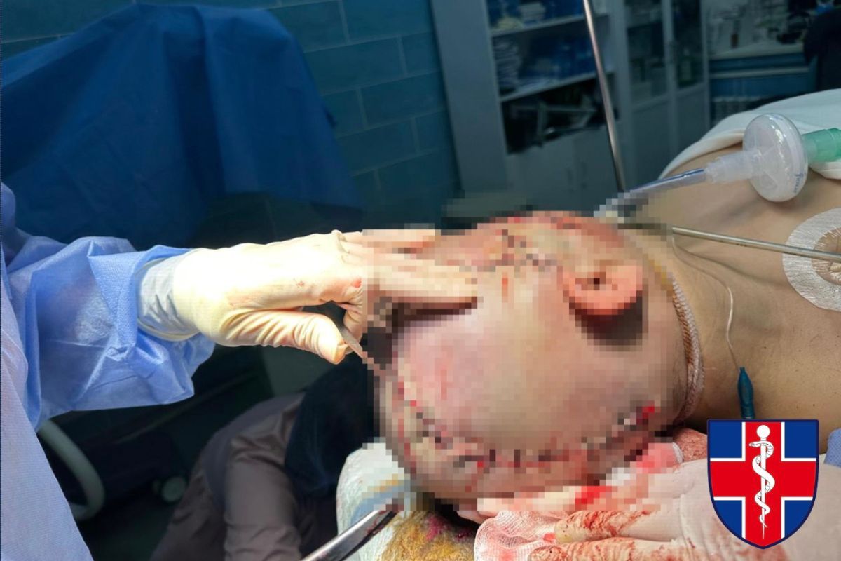 Операція тривала п’ять годин: медики з Дніпропетровської області врятували життя важкопораненому військовому 1