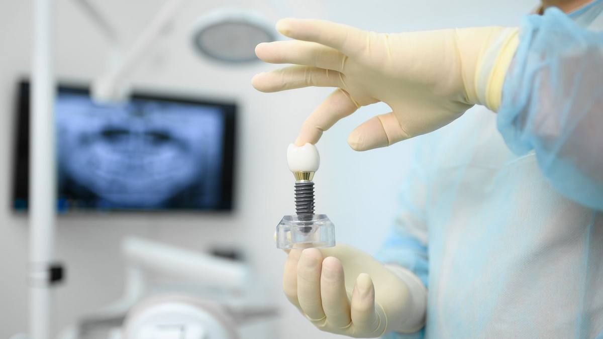 Чи можна на один зубний імплант поставити дві коронки: пояснення стоматолога