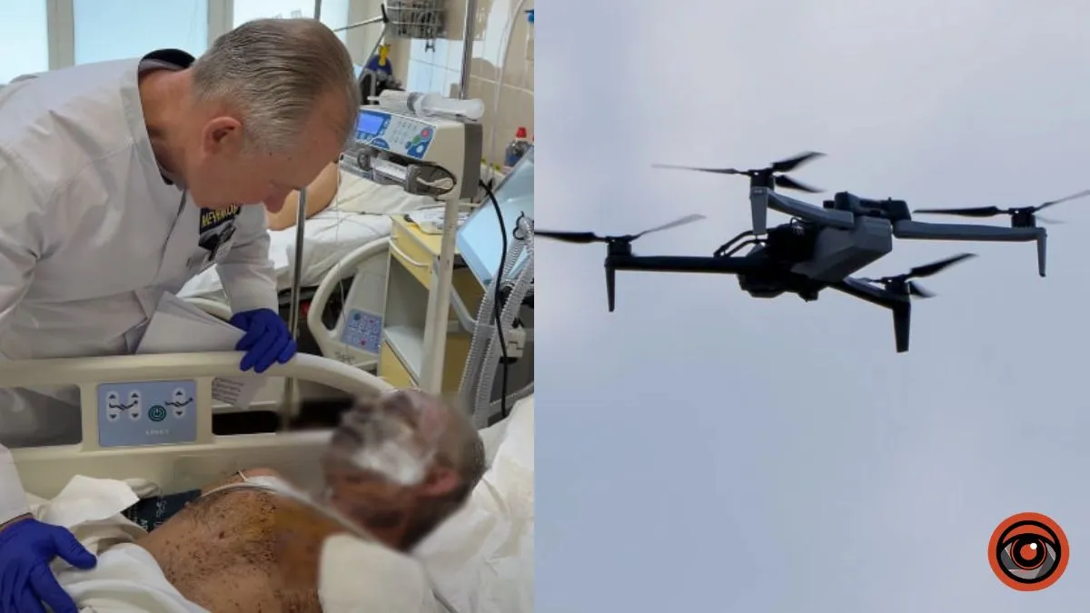 “Я виліз, щоб не згоріти, і повз дорогою”: у Дніпрі медики рятують селянина після удару ворожого FPV-дрона по авто