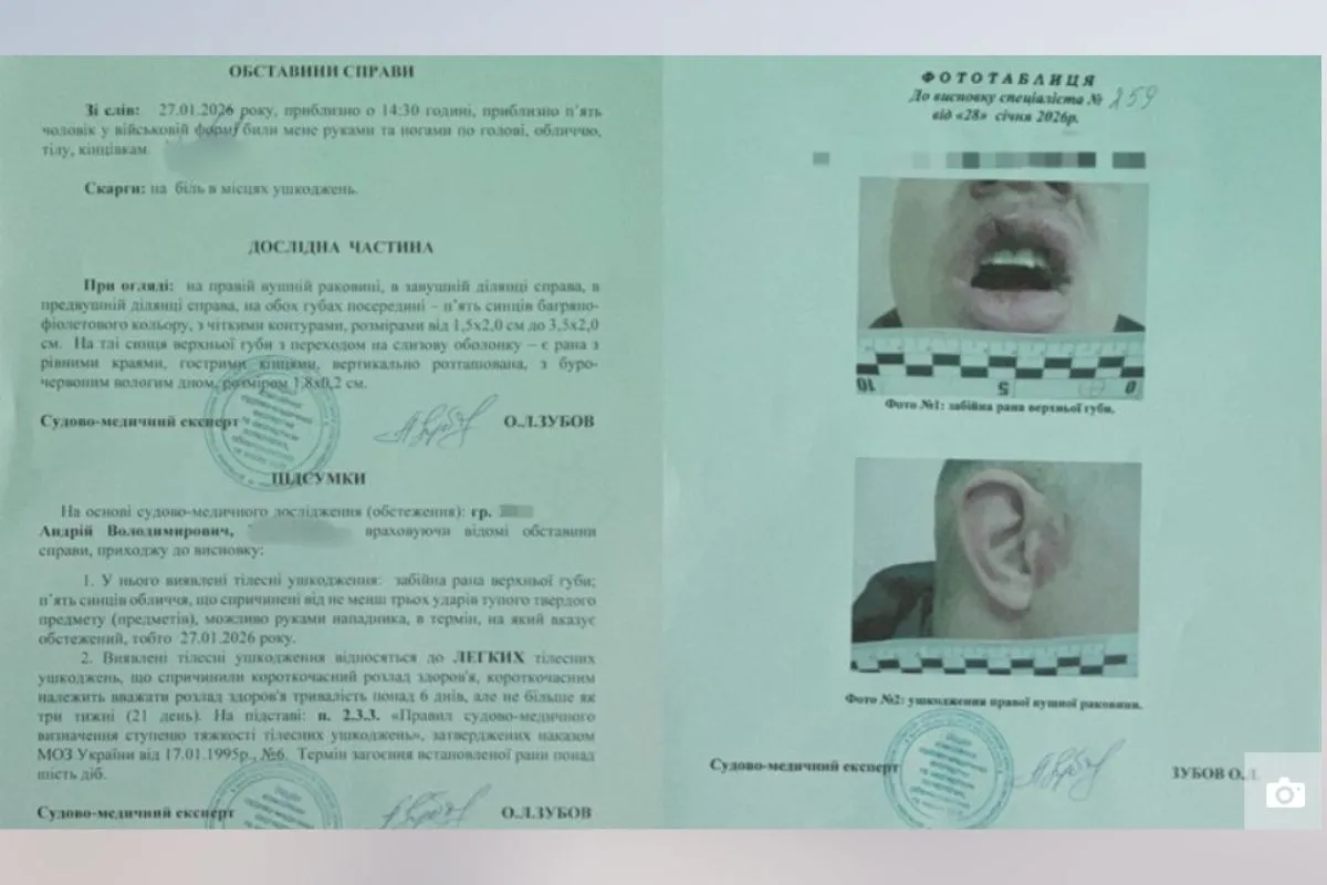 Чоловік отримав струс мозку та черепно-мозкову травму