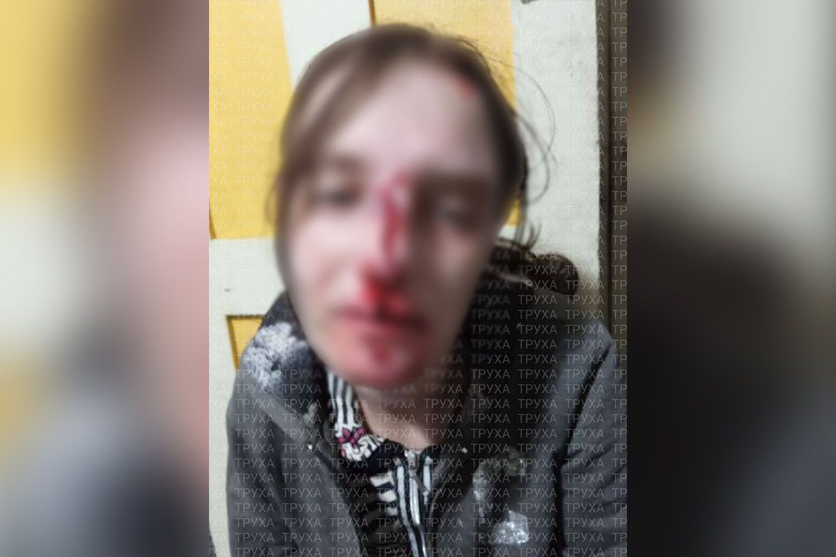 У Кривому Розі вівчарка накинулась на дівчину