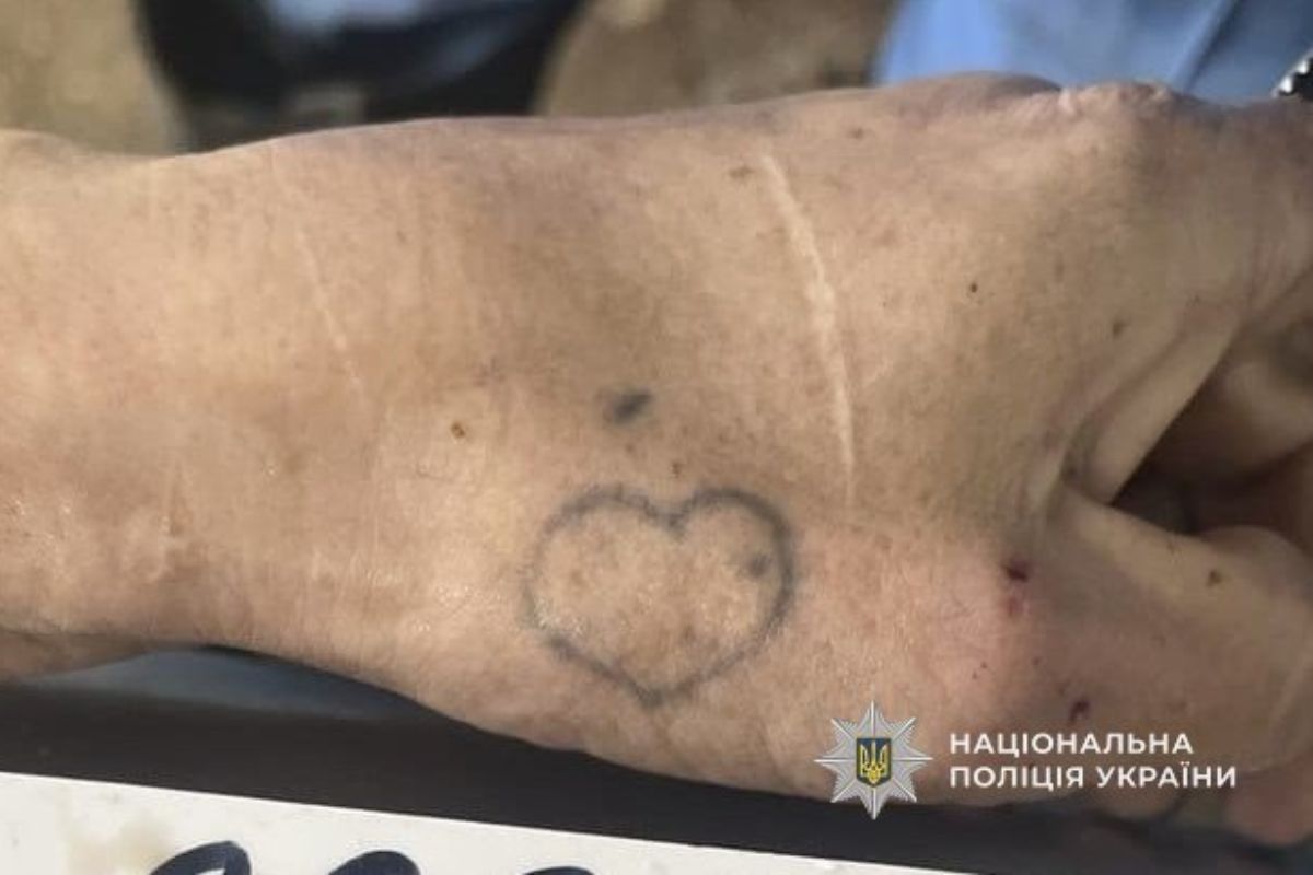 Татуювання та шрам на руці загиблої Татуювання та шрам на руці загиблої