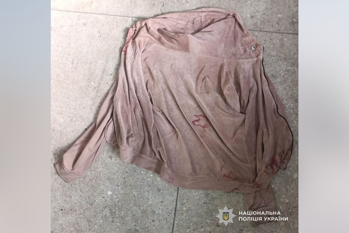 Рожева кофта з капюшоном на блискавці Потрібна допомога: поліція намагається встановити особу загиблої у ДТП у Дніпропетровській області 4