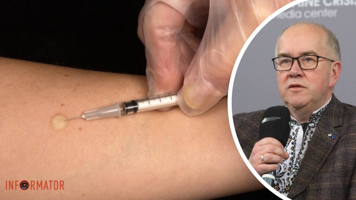 С апреля в Украине отменяют пробу Манту: как теперь будут обнаруживать туберкулез