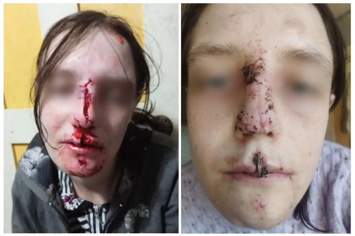 У Кривому Розі вівчарка накинулась на дівчину У Кривому Розі вівчарка накинулась на дівчину