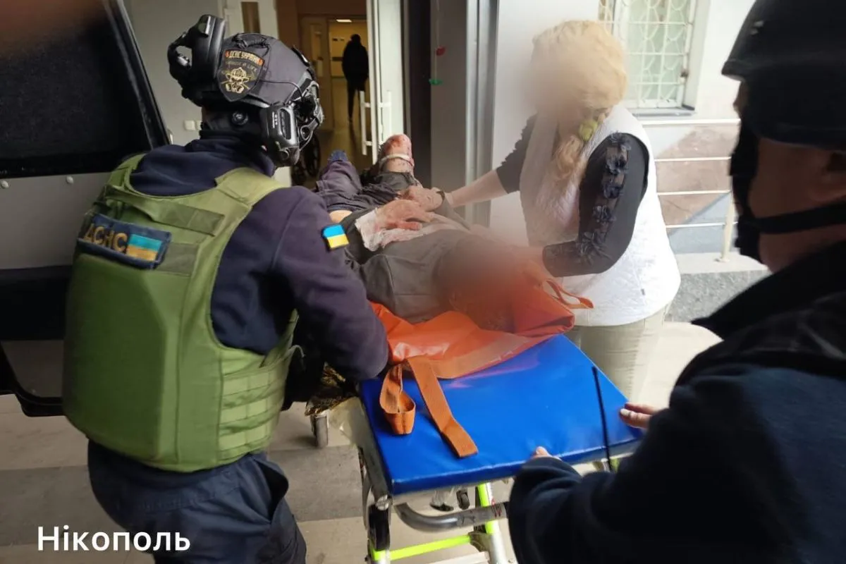 Внаслідок атак є поранені