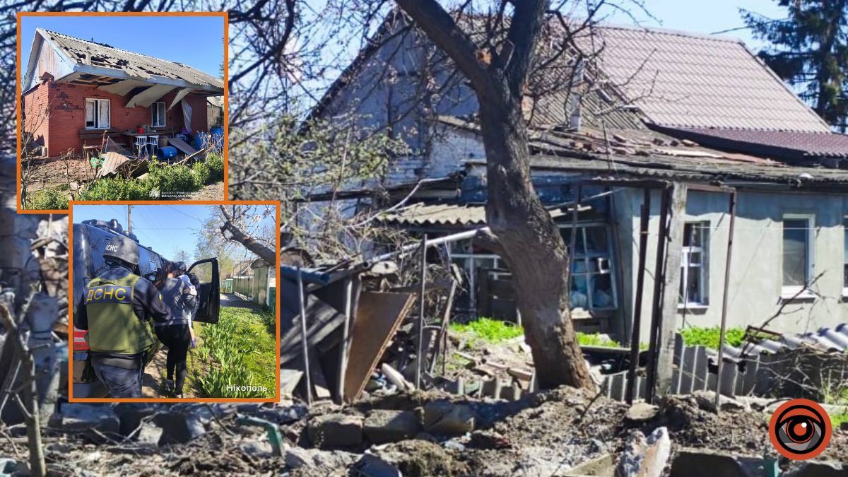 Серед постраждалих – 1,5-річна дівчинка, її доставили до Дніпра: ворог вдарив по Нікополю з артилерії