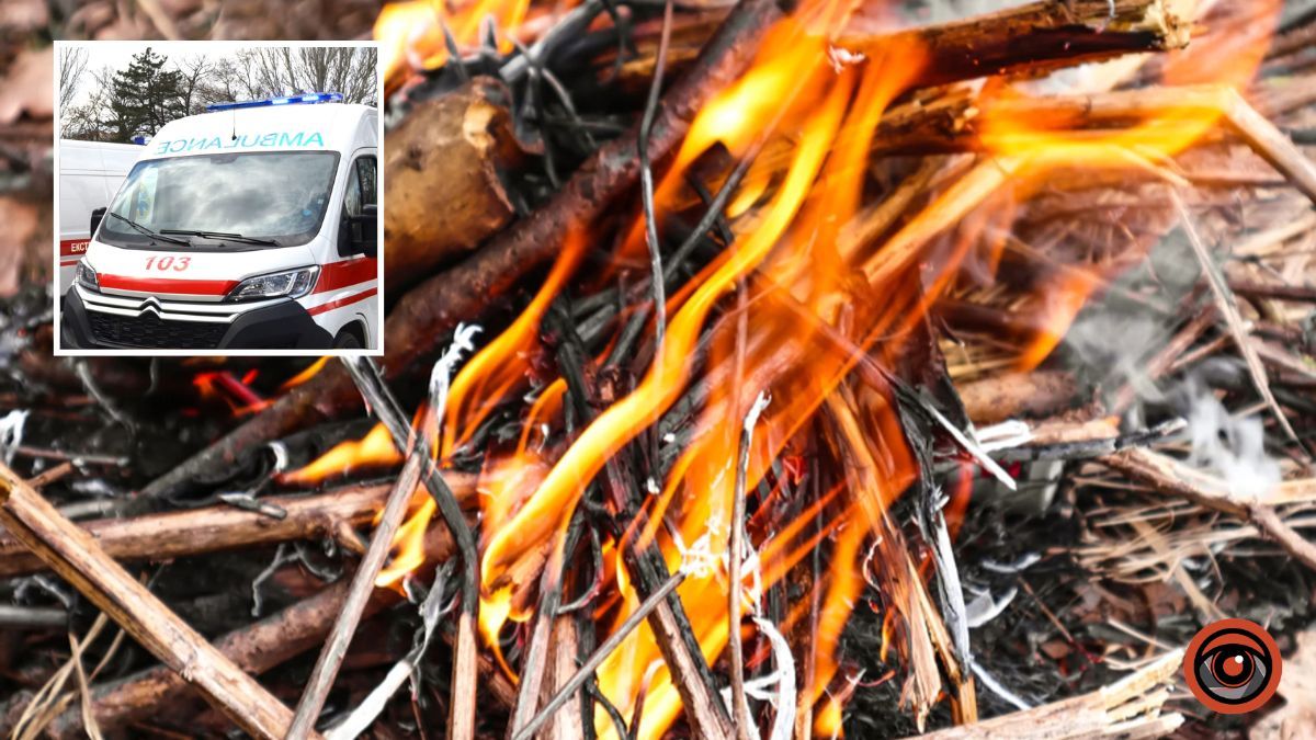 Загорівся одяг: у Дніпропетровській області чоловік отримав важкі опіки під час спалювання сміття на подвір’ї