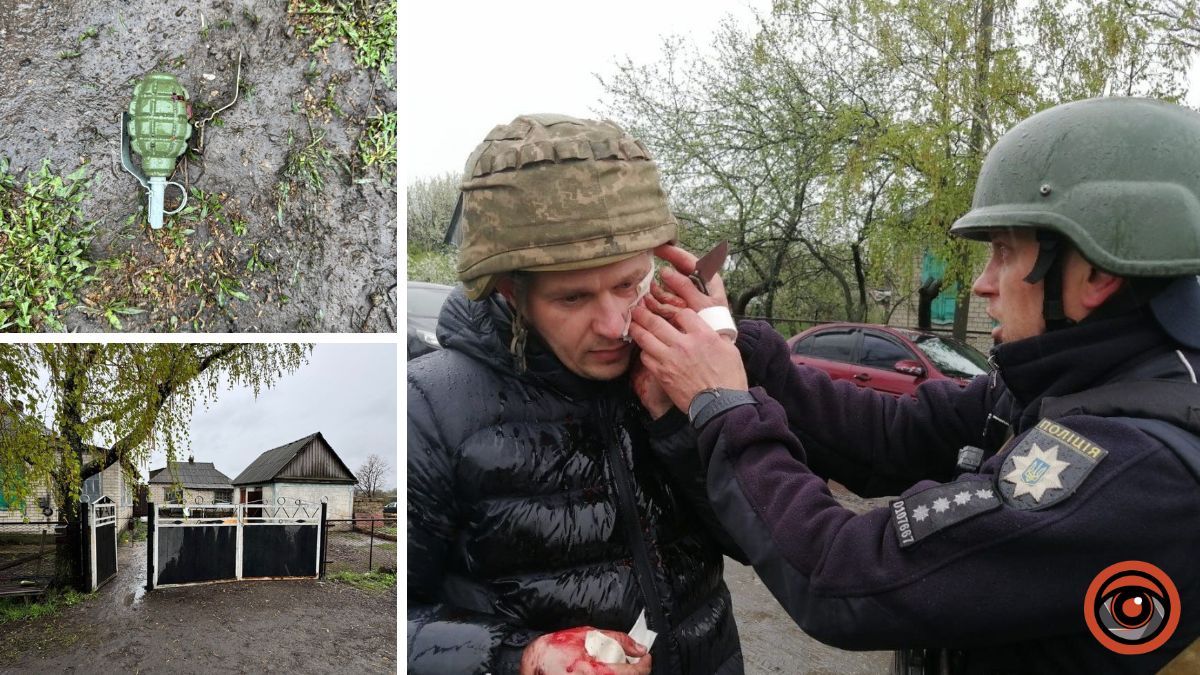 П'ятеро поліцейських поранені: у Дніпропетровській області чоловік кинув дві гранати в правоохороонців