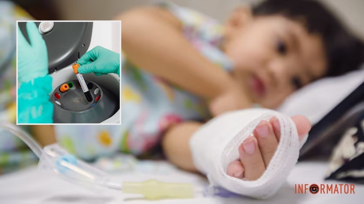 Кір і сплеск ГРВІ: яка епідемічна ситуація у Дніпрі та області