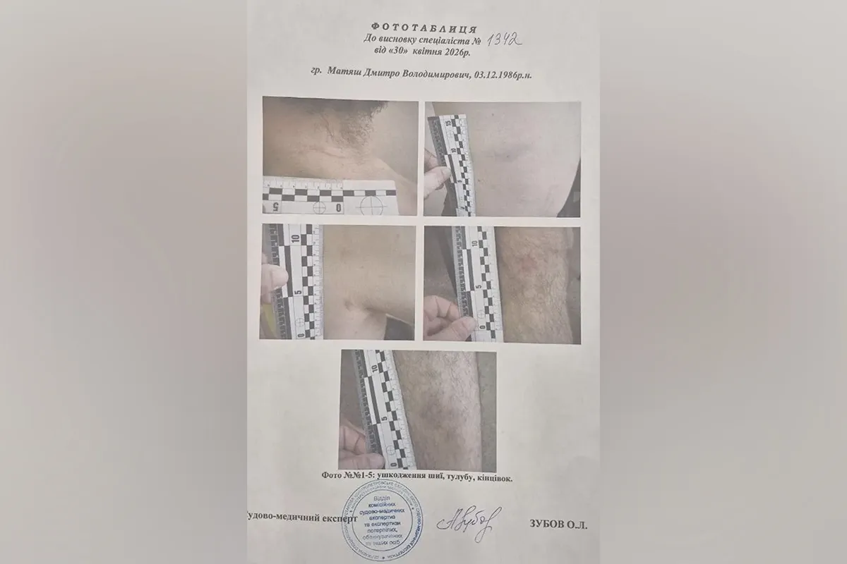 Документ с зафиксированными побоями