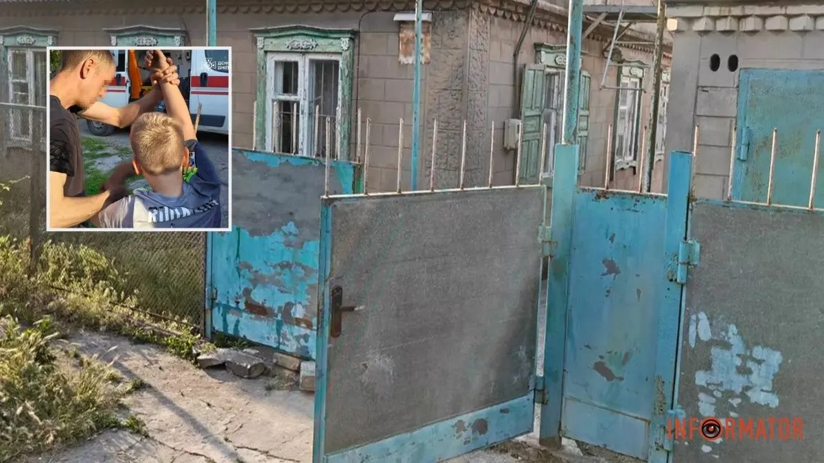 У Кам’янському 10-річний хлопчик напоровся на металевий штир: його рятували надзвичайники