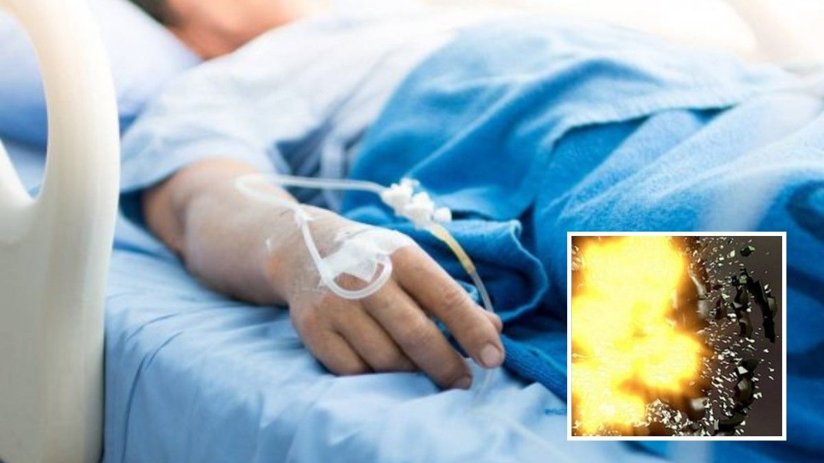 У Дніпрі 43-річний чоловік намагався розплавити фрагмент боєприпасу і той вибухнув: постраждалий помер у медзакладі