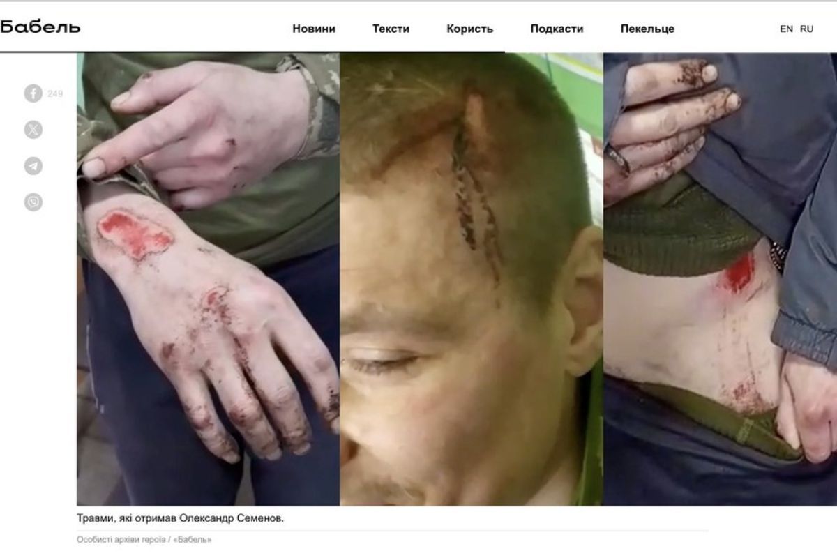 Кадри з травмами